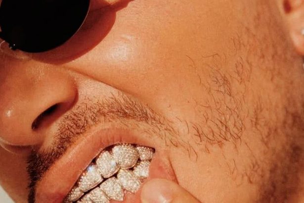 J Balvin, inconveniente, dientes, atorado, diamantes, oro, look, extravagante, viral, video, redes sociales, Instagram, Stars World Production